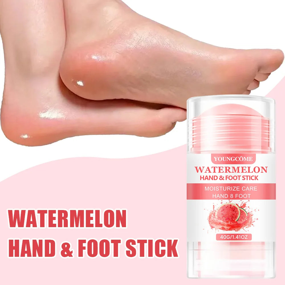 Watermelon Foot Cream - Ultra-Hydrating for Dry Cracked Feet