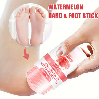 Watermelon Foot Cream - Ultra-Hydrating for Dry Cracked Feet
