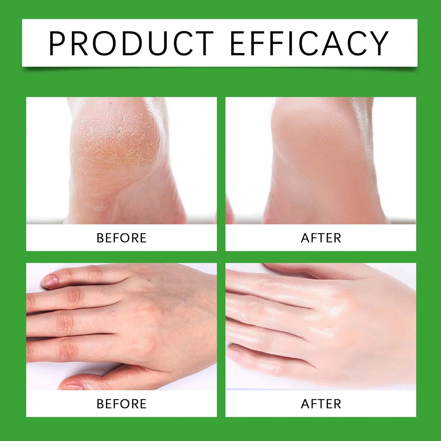 Foot Cream Stick - Moisturising Heel Crack Repair for Very Dry Skin