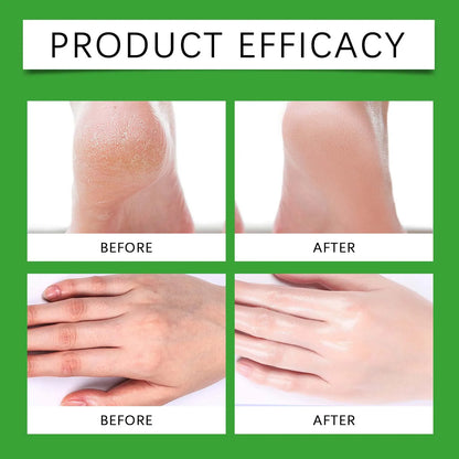 Foot Cream Stick - Moisturising Heel Crack Repair for Very Dry Skin