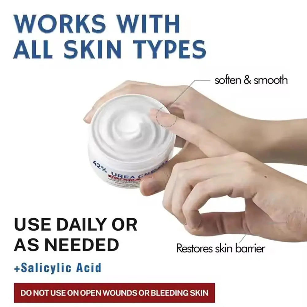 Urea Cream 40% - Intensive Hand & Foot Moisturiser with Vitamin E