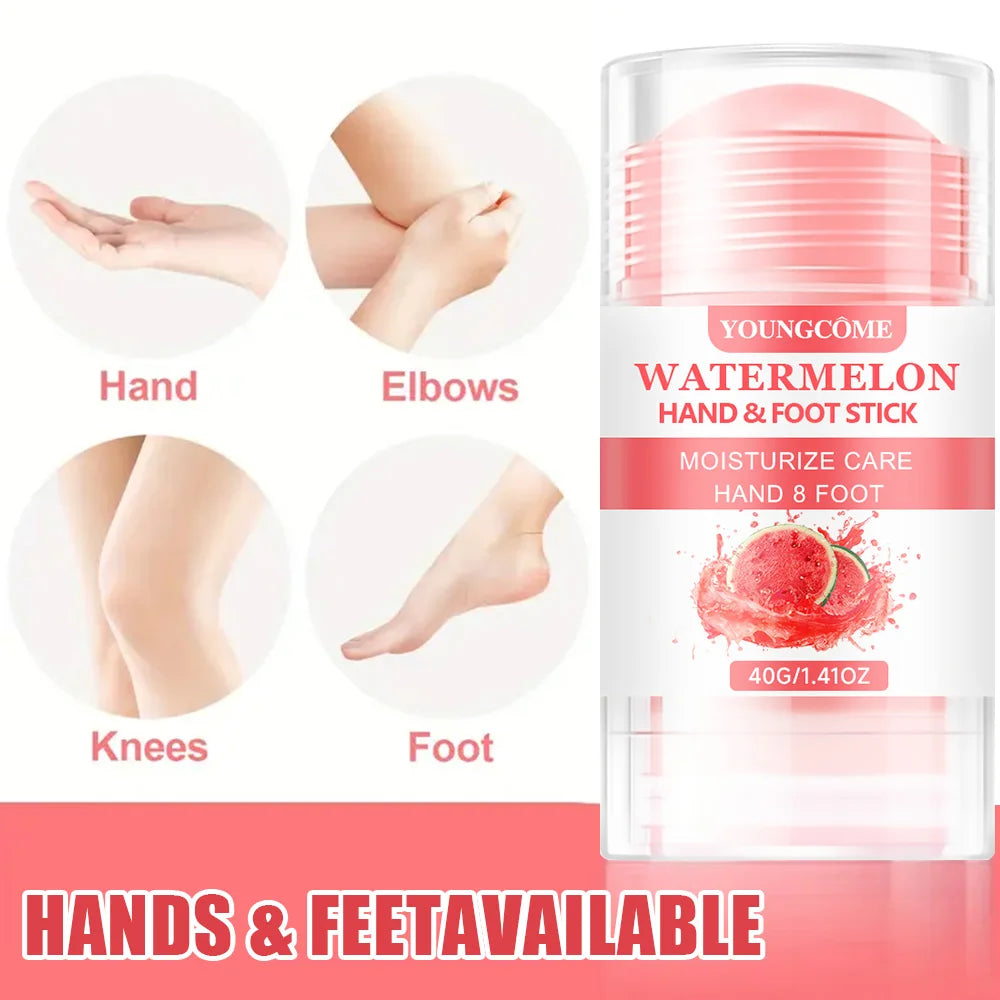 Watermelon Foot Cream - Ultra-Hydrating for Dry Cracked Feet